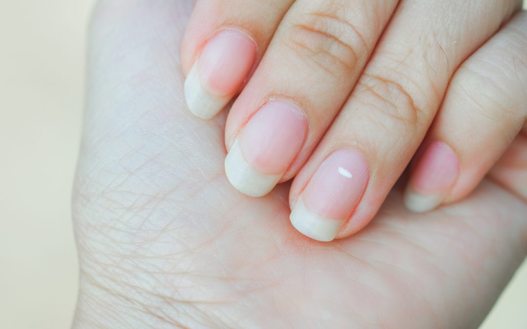 Tâches blanches sur les ongles : un signe de manque de magnésium ?